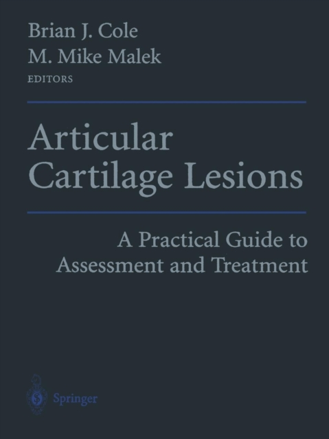 Articular Cartilage Lesions : A Practical Guide to Assessment and Treatment, Paperback / softback Book