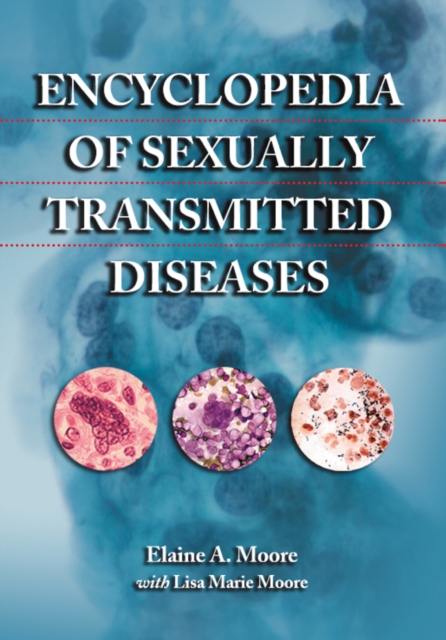 Encyclopedia of Sexually Transmitted Diseases, PDF eBook