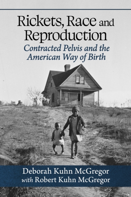 Rickets, Race and Reproduction : Contracted Pelvis and the American Way of Birth, Paperback / softback Book