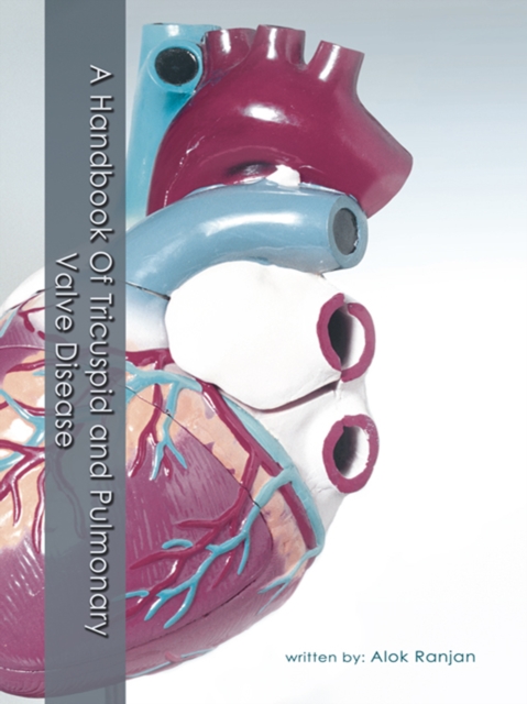 A Handbook of Tricuspid and Pulmonary Valve Disease, EPUB eBook