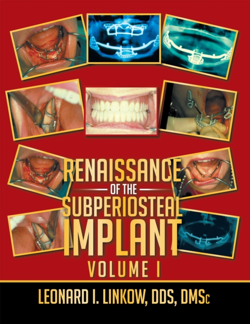 Renaissance of the Subperiosteal Implant Volume I, EPUB eBook