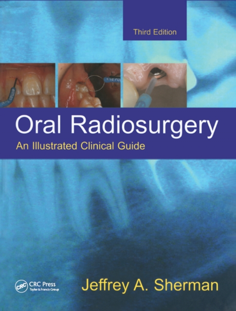 Oral Radiosurgery : An Illustrated Clinical Guide, PDF eBook