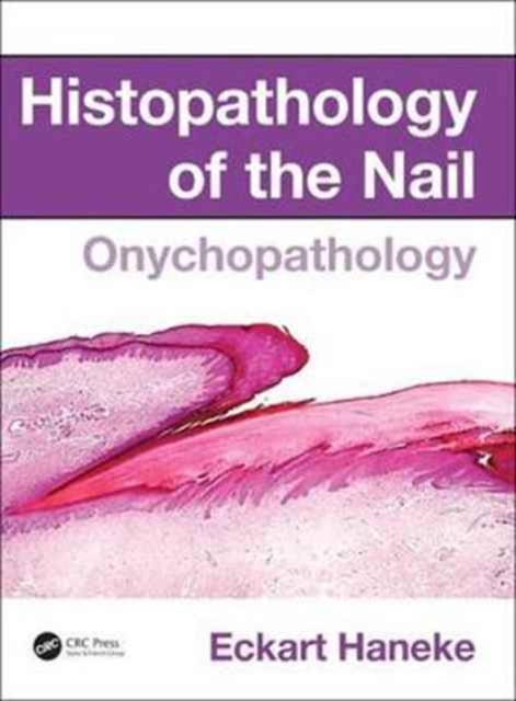 Histopathology of the Nail : Onychopathology,  Book
