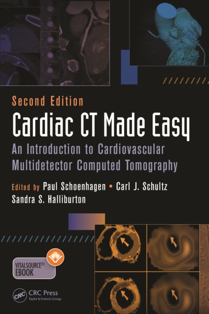 Cardiac CT Made Easy : An Introduction to Cardiovascular Multidetector Computed Tomography, Second Edition, PDF eBook