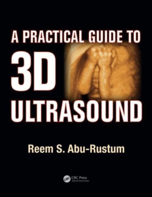 A Practical Guide to 3D Ultrasound, Paperback / softback Book