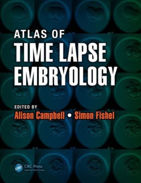 Atlas of Time Lapse Embryology, Paperback / softback Book