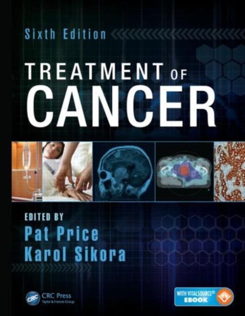 Treatment of Cancer, Hardback Book