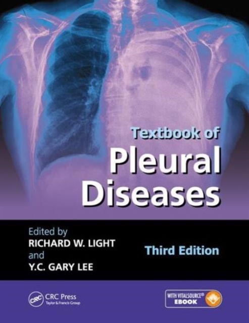 Textbook of Pleural Diseases, Hardback Book