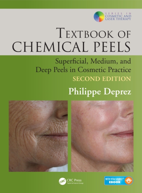 Textbook of Chemical Peels : Superficial, Medium, and Deep Peels in Cosmetic Practice, PDF eBook