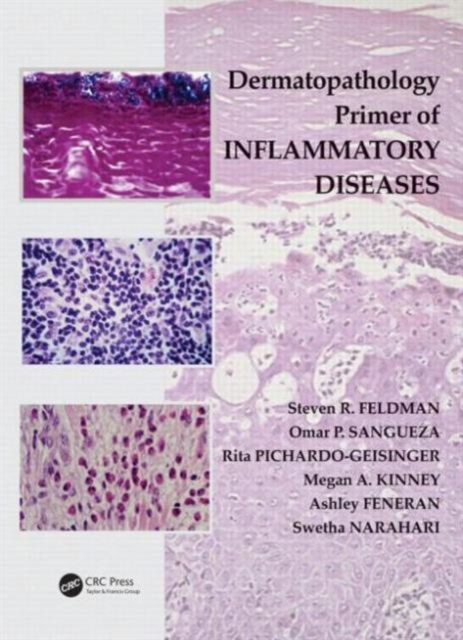 Dermatopathology Primer of Inflammatory Diseases, Paperback / softback Book
