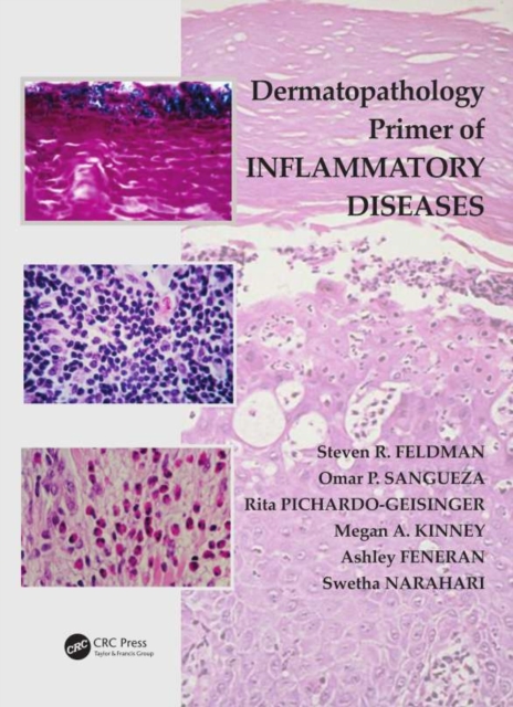 Dermatopathology Primer of Inflammatory Diseases, PDF eBook
