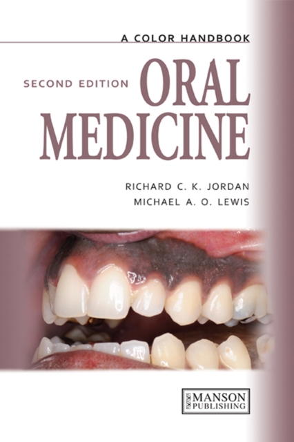 Oral Medicine, EPUB eBook