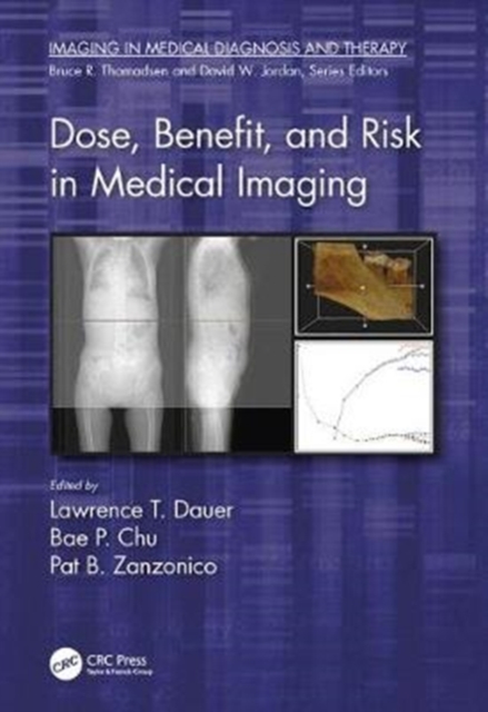Dose, Benefit, and Risk in Medical Imaging, Hardback Book