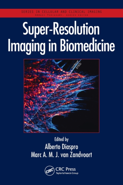 Super-Resolution Imaging in Biomedicine, Hardback Book