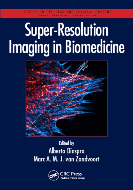 Super-Resolution Imaging in Biomedicine, PDF eBook