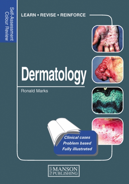 Dermatology : Self-Assessment Colour Review, PDF eBook