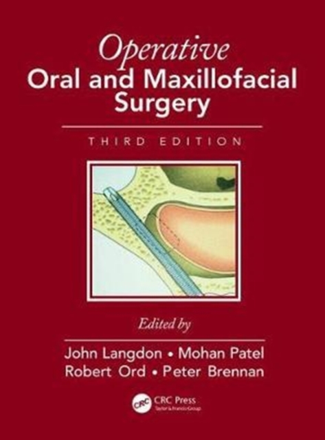 Operative Oral and Maxillofacial Surgery, Hardback Book