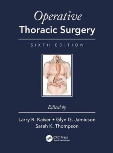 Operative Thoracic Surgery, Hardback Book
