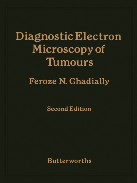 Diagnostic Electron Microscopy of Tumours, PDF eBook