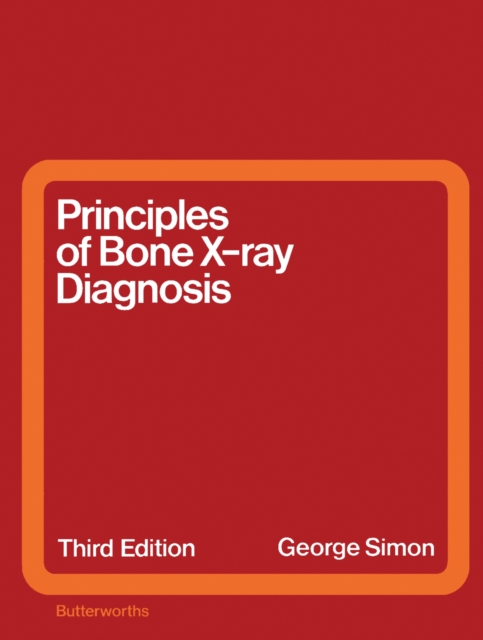 Principles of Bone X-Ray Diagnosis, PDF eBook