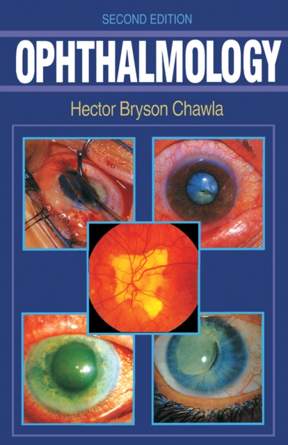 Ophthalmology, PDF eBook