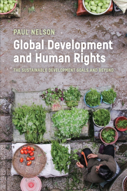Global Development and Human Rights : The Sustainable Development Goals and Beyond, Hardback Book