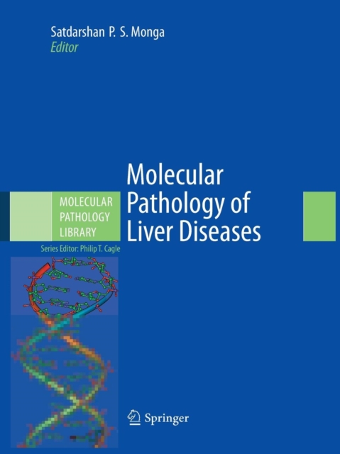Molecular Pathology of Liver Diseases, Paperback / softback Book