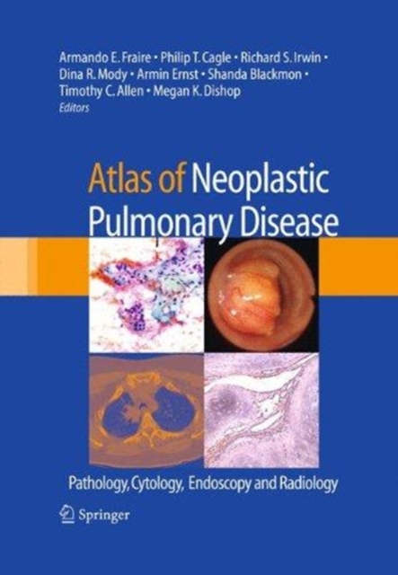 Atlas of Neoplastic Pulmonary Disease : Pathology, Cytology, Endoscopy and Radiology, Paperback / softback Book