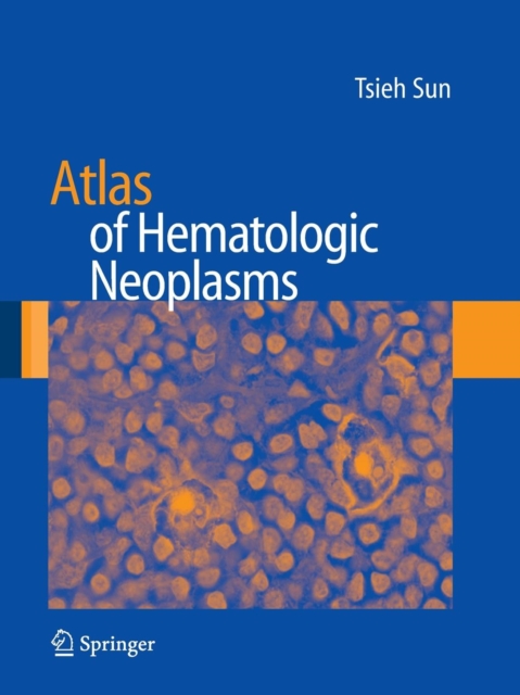 Atlas of Hematologic Neoplasms, Paperback / softback Book