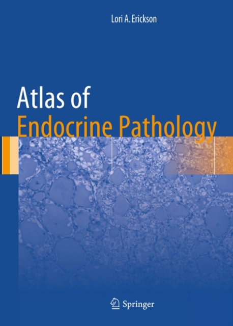 Atlas of Endocrine Pathology, PDF eBook