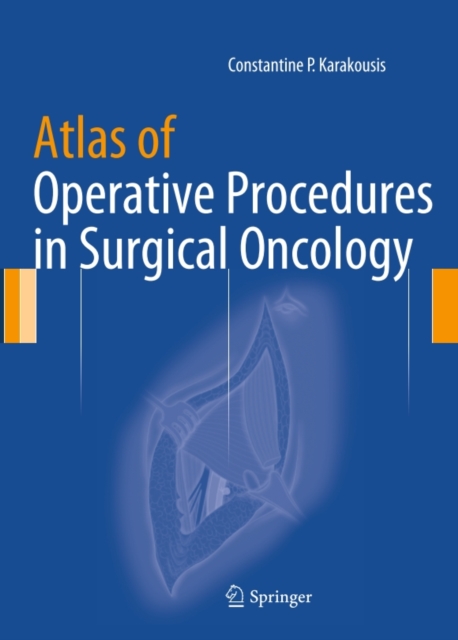 Atlas of Operative Procedures in Surgical Oncology, PDF eBook