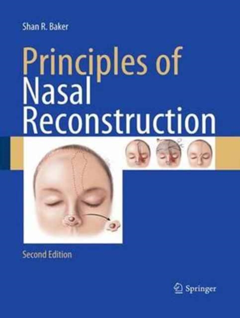 Principles of Nasal Reconstruction, Paperback / softback Book
