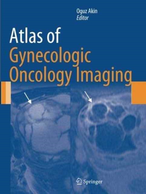 Atlas of Gynecologic Oncology Imaging, Paperback / softback Book