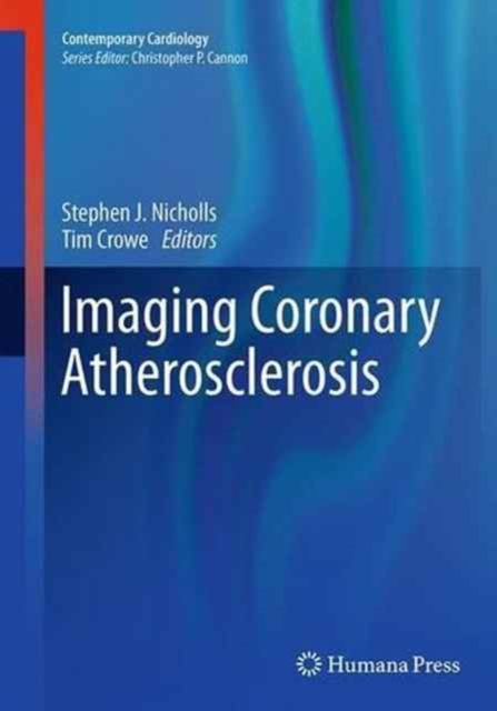 Imaging Coronary Atherosclerosis, Paperback / softback Book