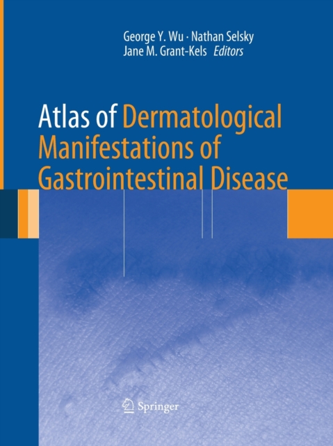 Atlas of Dermatological Manifestations of Gastrointestinal Disease, Paperback / softback Book
