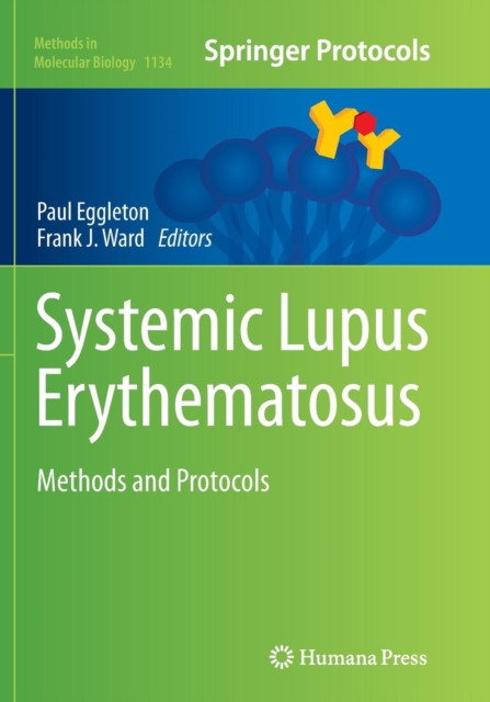 Systemic Lupus Erythematosus : Methods and Protocols, Paperback / softback Book