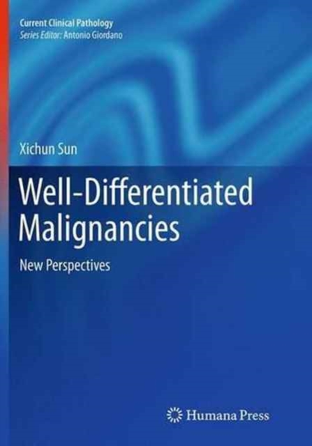 Well-Differentiated Malignancies : New Perspectives, Paperback / softback Book