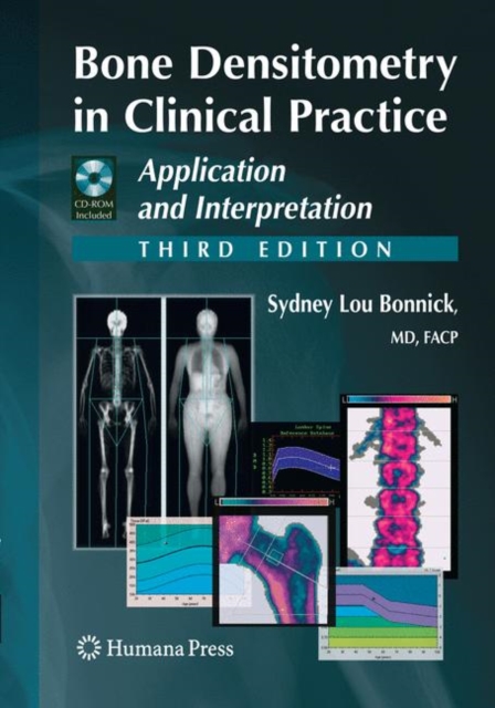 Bone Densitometry in Clinical Practice : Application and Interpretation, Paperback / softback Book