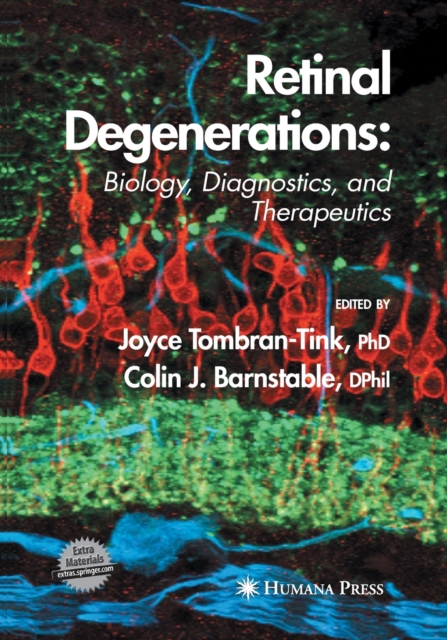 Retinal Degenerations : Biology, Diagnostics, and Therapeutics, Paperback / softback Book