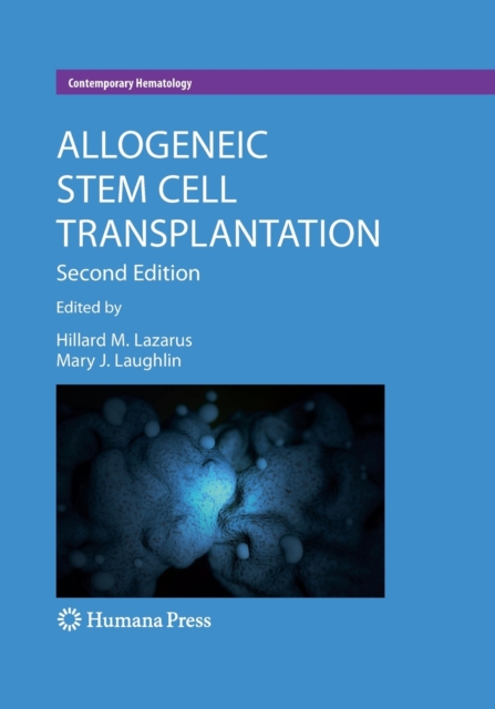 Allogeneic Stem Cell Transplantation, Paperback / softback Book