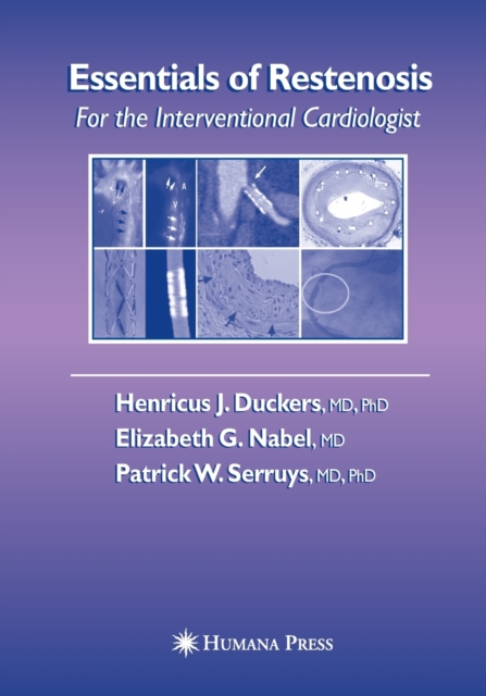 Essentials of Restenosis : For the Interventional Cardiologist, Paperback / softback Book
