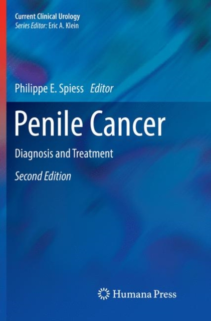 Penile Cancer : Diagnosis and Treatment, Paperback / softback Book