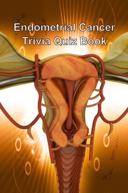 Endometrial Cancer Trivia Quiz Book, Paperback / softback Book
