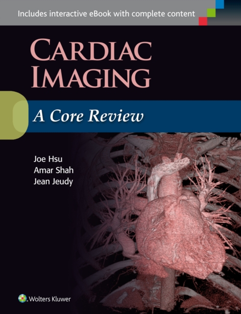 Cardiac Imaging: A Core Review, Paperback / softback Book
