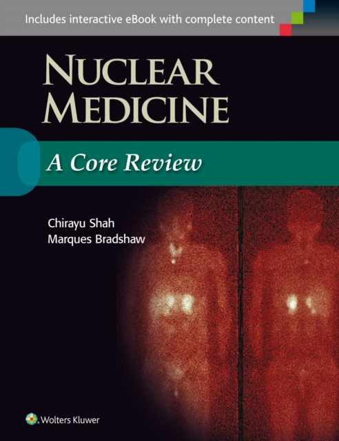 Nuclear Medicine: A Core Review, Paperback / softback Book