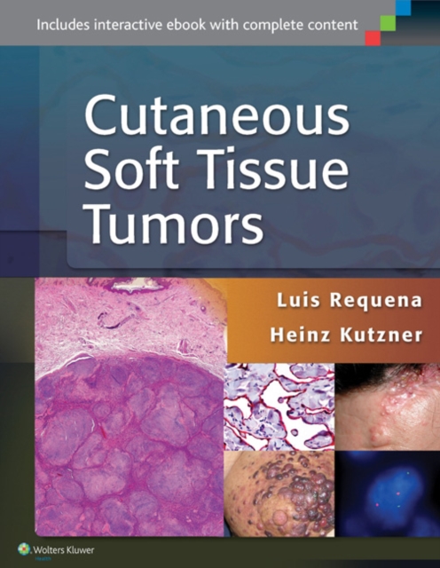 Cutaneous Soft Tissue Tumors, EPUB eBook