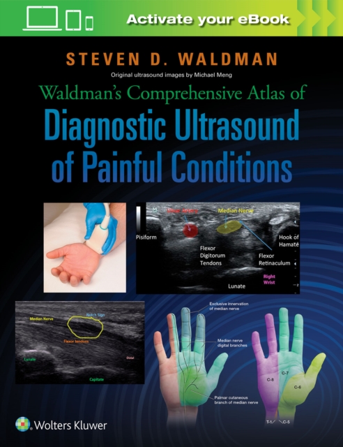 Waldman's Comprehensive Atlas of Diagnostic Ultrasound of Painful Conditions, Hardback Book