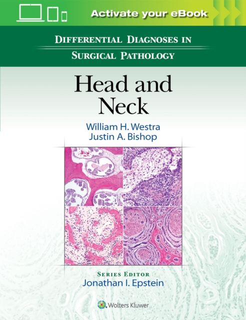 Differential Diagnoses in Surgical Pathology: Head and Neck, Hardback Book
