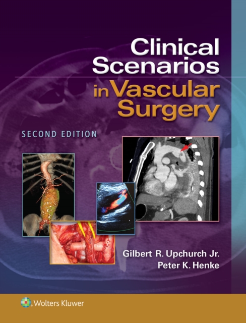 Clinical Scenarios in Vascular Surgery, EPUB eBook