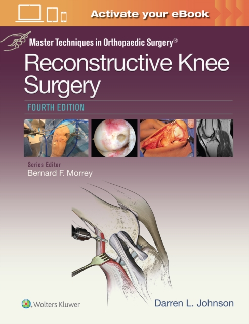 Master Techniques in Orthopaedic Surgery: Reconstructive Knee Surgery, Hardback Book